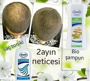sac dokulmesını onleyıp saci besleyen yenı sacikaran alti sampuan (1)(1)